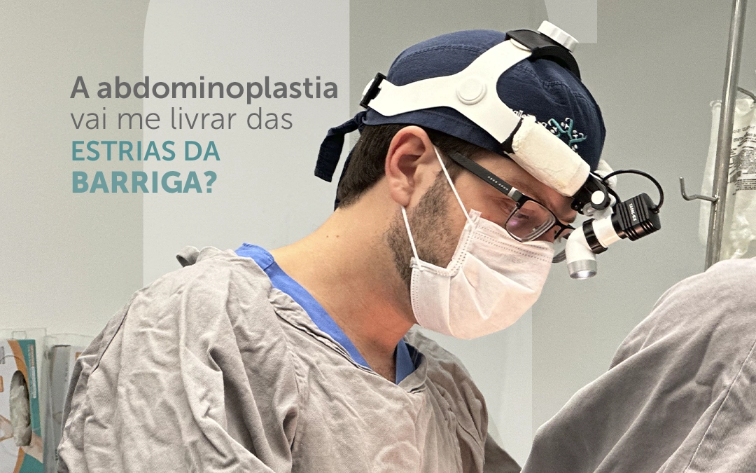 A abdominoplastia vai me livrar das estrias da barriga?