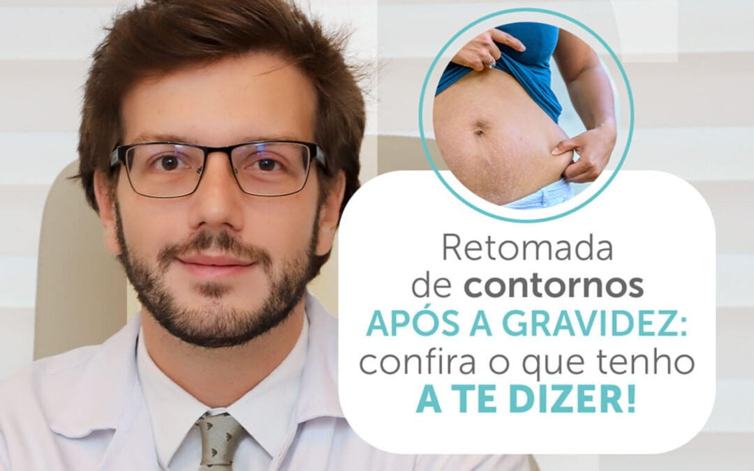 Retomada de contornos após a gravidez: confira o que tenho a te dizer!