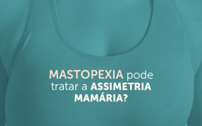 Mastopexia pode tratar a assimetria mamária?