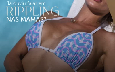 Já ouviu falar em rippling nas mamas?